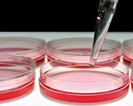 transfection
