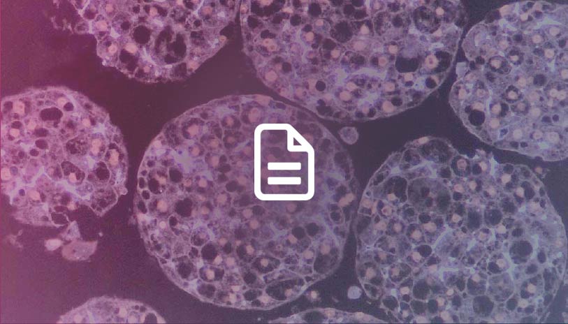 An Automated Multiplexed Hepatotoxicity and CYP Induction Assay Using HepaRG Cells in 2D and 3D