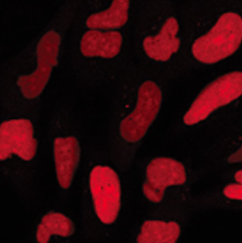 Cell image of parental U2OS cells and U2OS cells stably expressing HaloTag® protein fused to three copies of a nuclear localization sequence (labeled with Janelia Fluor® JFX 554 HaloTag® Ligand).