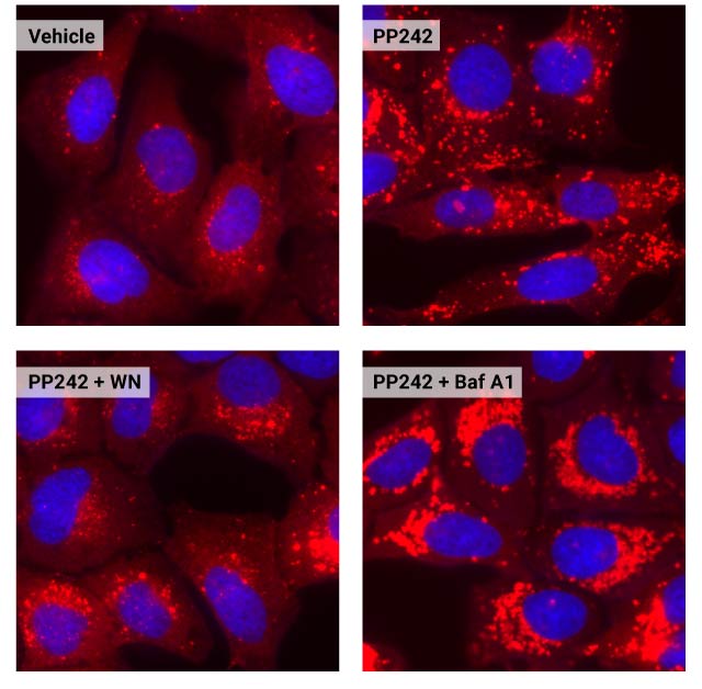 Autophagy Assay | LC3 | Autophagic Flux Assay | Promega